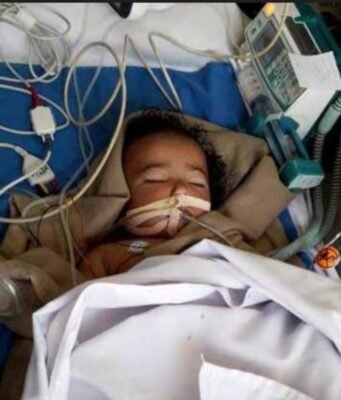 कोयलांचल : सिरप कांड के बाद, चिल्ड्रन ट्रीटमेंट सिस्टम डिस्ट्रॉय !