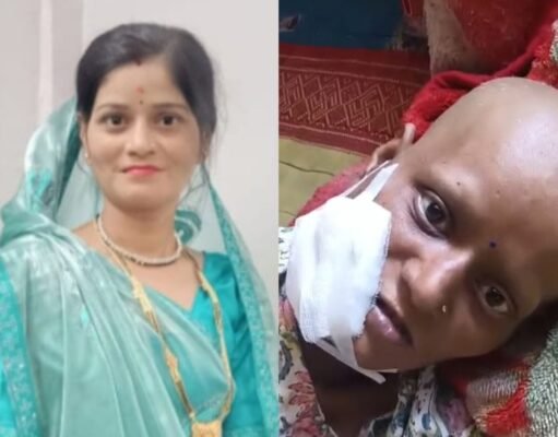 गलत इलाज : मौत के मुंह में पहुंच गई 38 साल की कामना ।